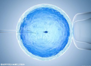 时差培养箱
